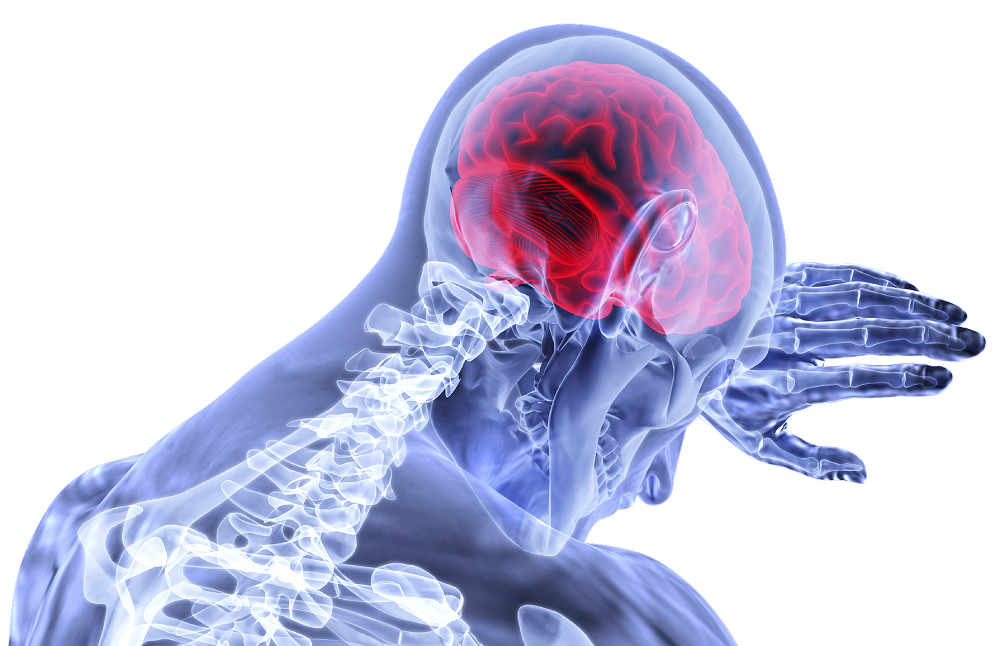 Causes of Stroke